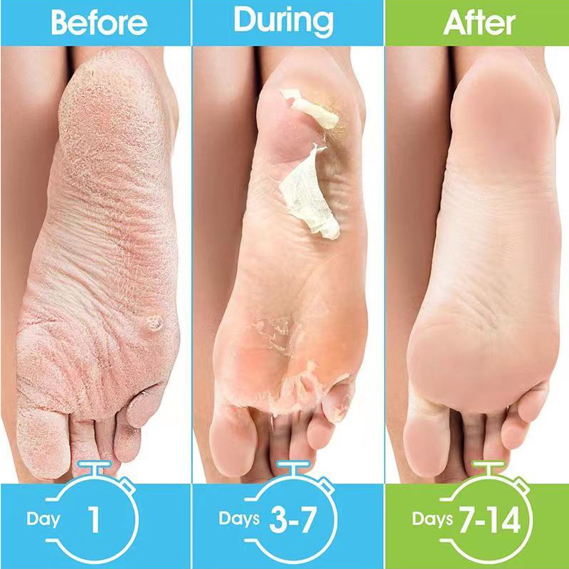 1 Pag=1 Pair Honey Foot Mask F - огляд і ціна Foot Mask Peeling