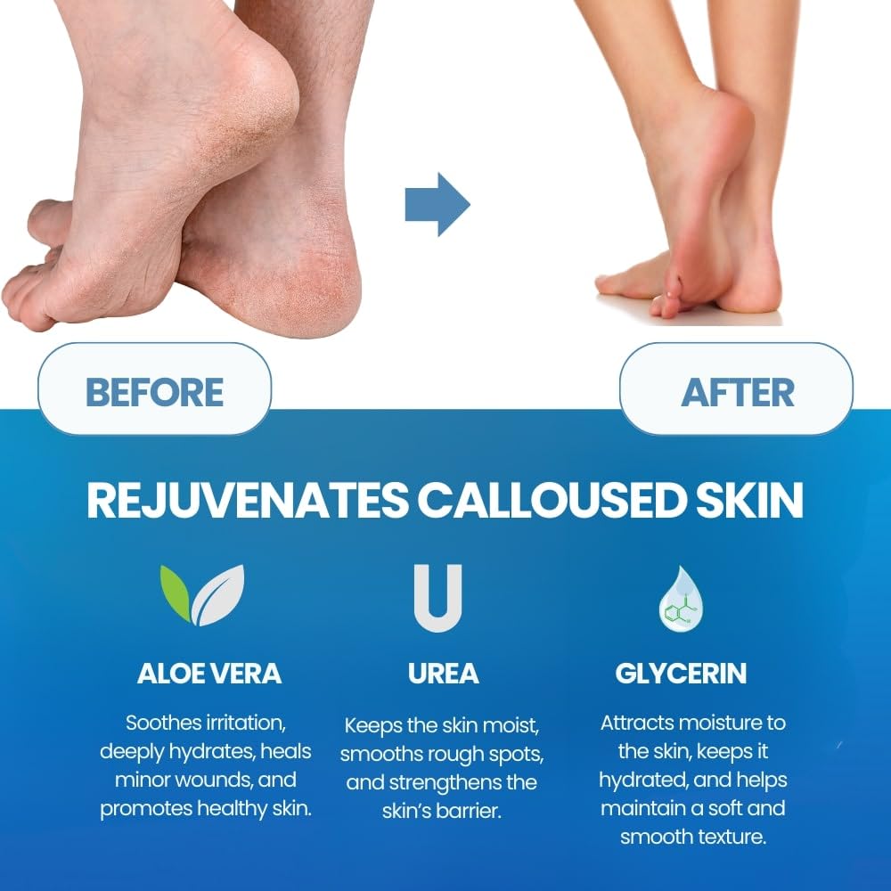 Foot Cuticle Remove Dead Foot  - огляд і ціна Foot Mask Peeling
