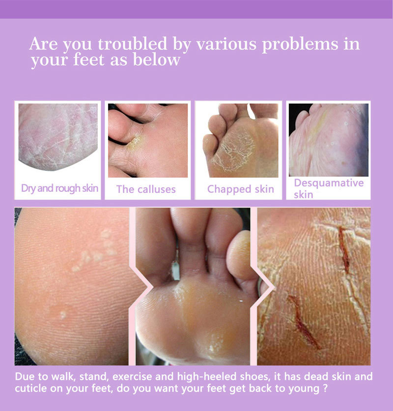 Feet Exfoliating Foot Masks Pe - огляд і ціна Foot Mask Peeling