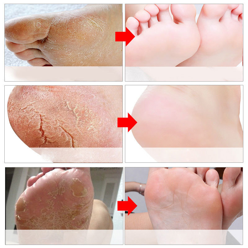 Feet Exfoliating Foot Masks Pe - огляд і ціна Foot Mask Peeling
